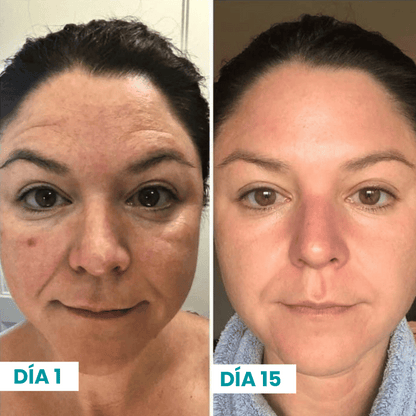 ¡EXCLUSIVO! 10% VITAMINA C ANTI-EDAD SERUM C-GLOW