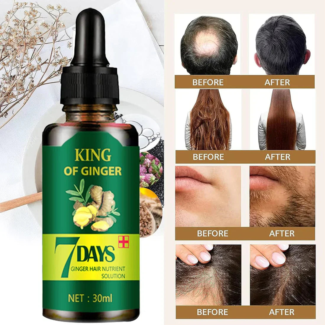 🚨GRAN LANZAMIENTO⚡️ - SERUM JENGIBRE  ANTI CAIDA Y CRECIMIENTO ACELERADO 7DAYS™