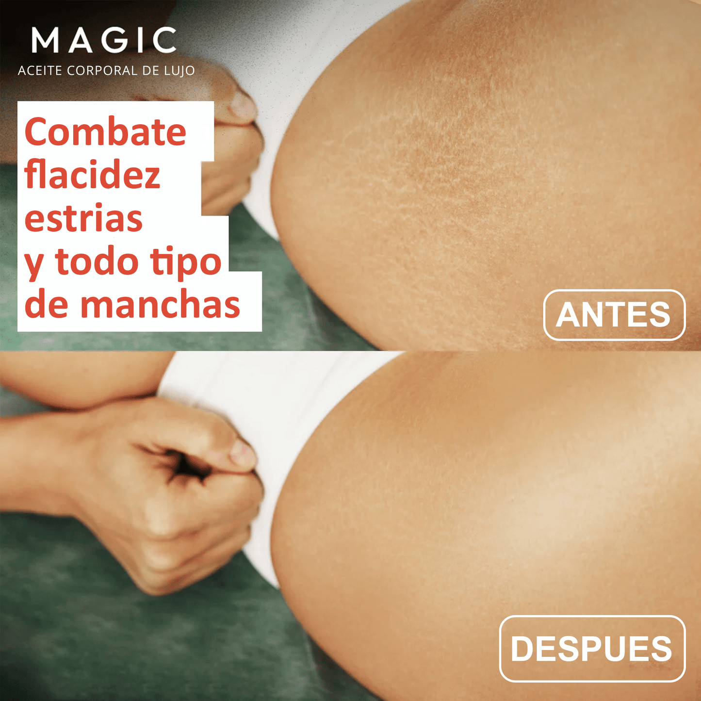 Aceite Original Corporal Magic™ (Comprá 1 y llevate 1 GRATIS (2 frascos)